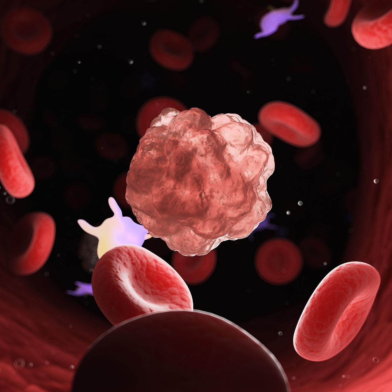 3D rendered medically accurate illustration of a cancer cell.