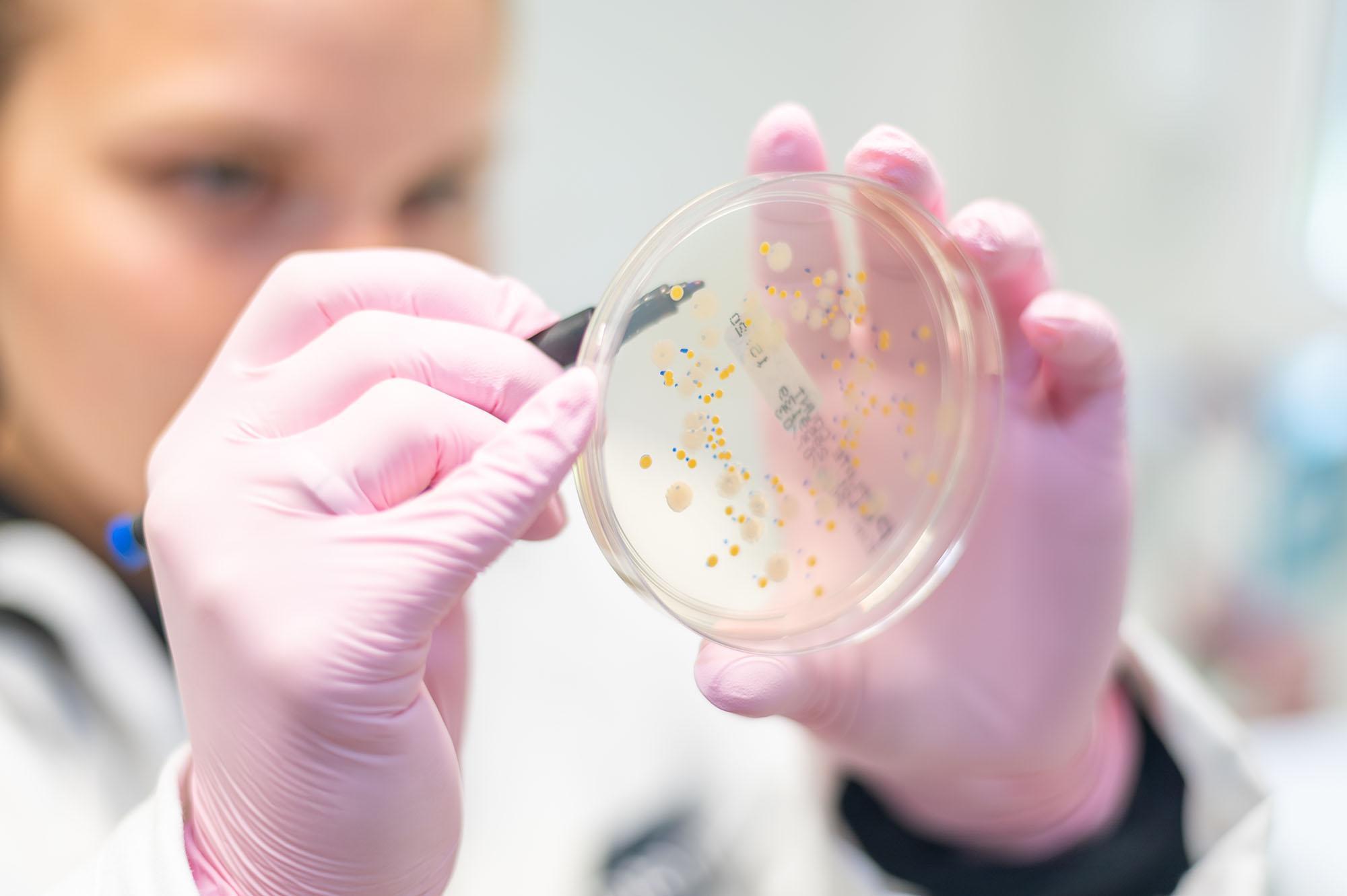 Bioveterinary Science student conducting microbiological research, analysing bacterial colonies on an agar plate to develop advanced skills in laboratory diagnostics and animal health sciences.