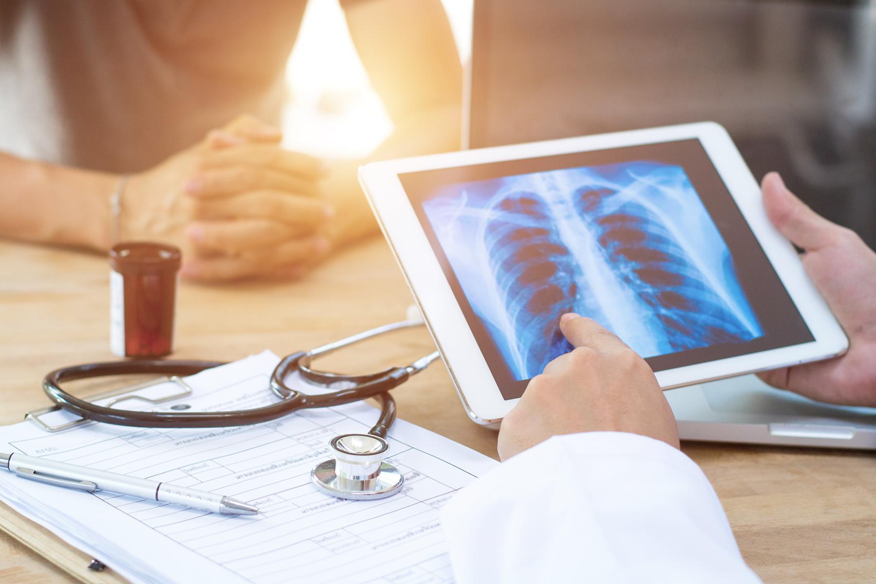 Healthcare professional reviewing a chest X-ray on a digital tablet during a clinical consultation, highlighting respiratory disease diagnosis, patient care and advanced respiratory healthcare studies for Respiratory Medicine MSc students at the University of Chester.
